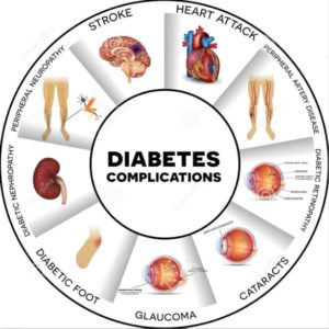 Bij diabetes ontstaan vaak complicaties zoals Glaucoom, Catarac en een open been.